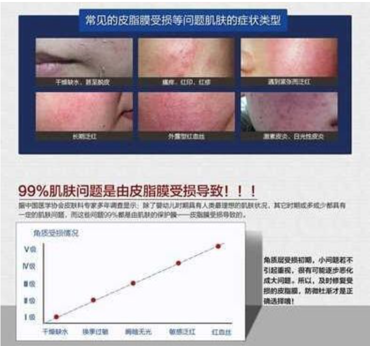 為什么你的臉容易過敏？